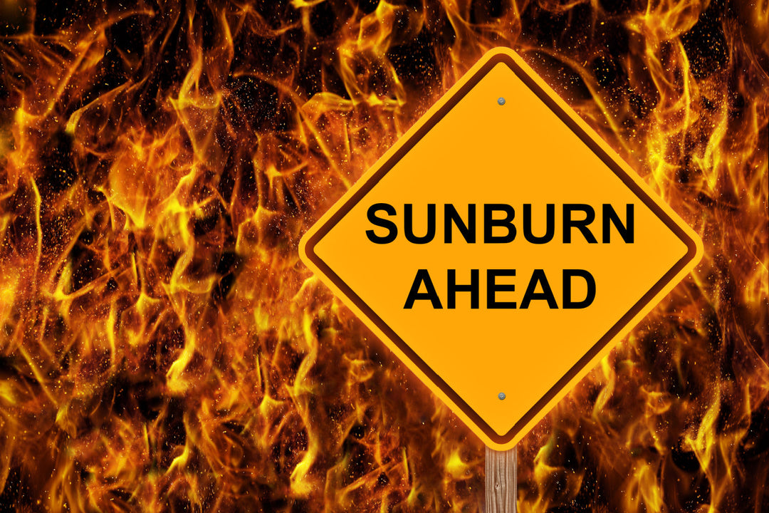 Sunburn Ahead warning sign with flames in the background